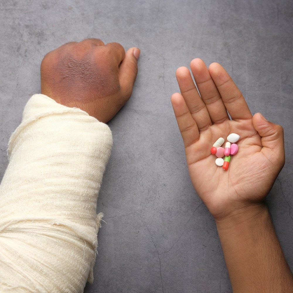 page-burn-injury-recovery Recovering from a burn injury