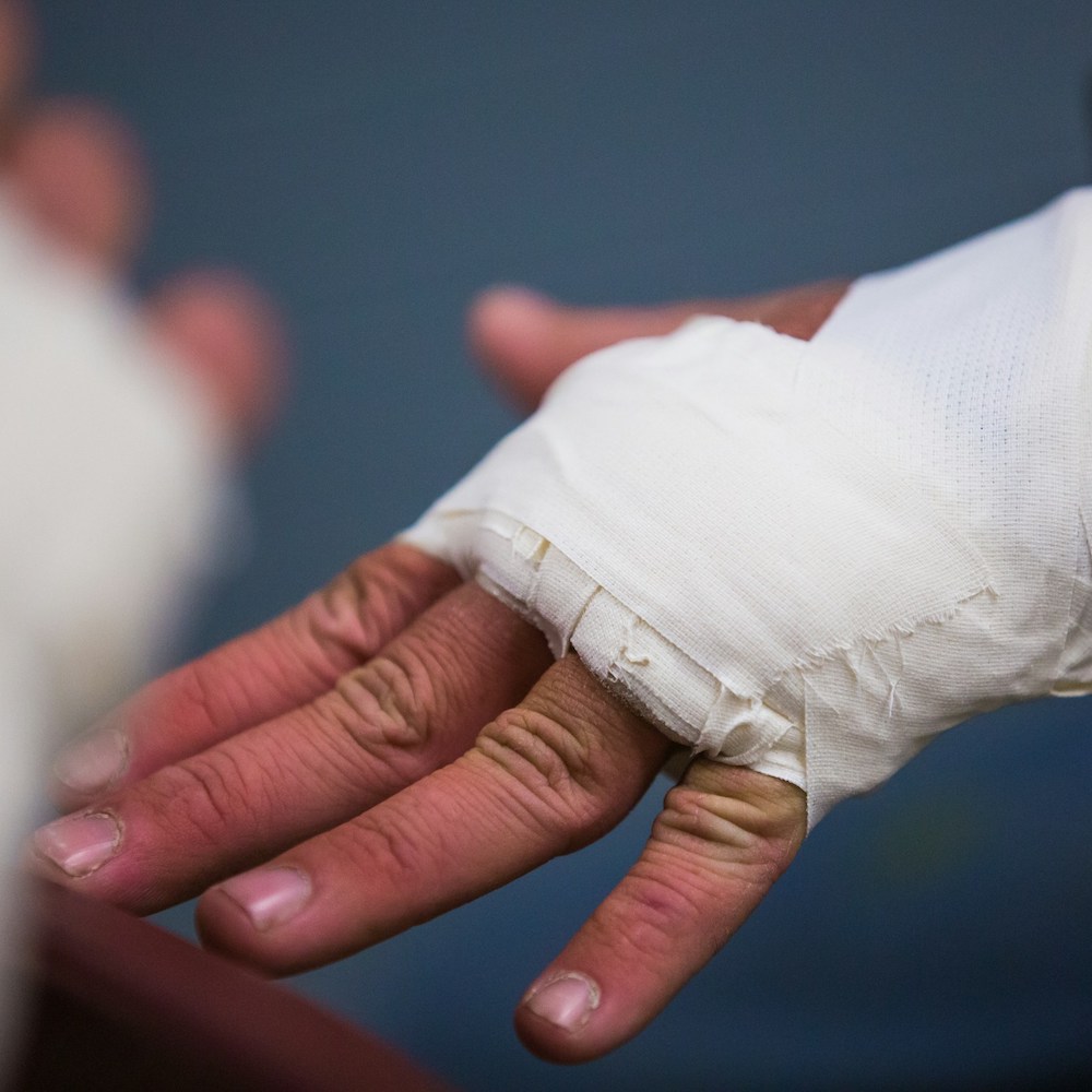 page-burn-injury Burn Injuries